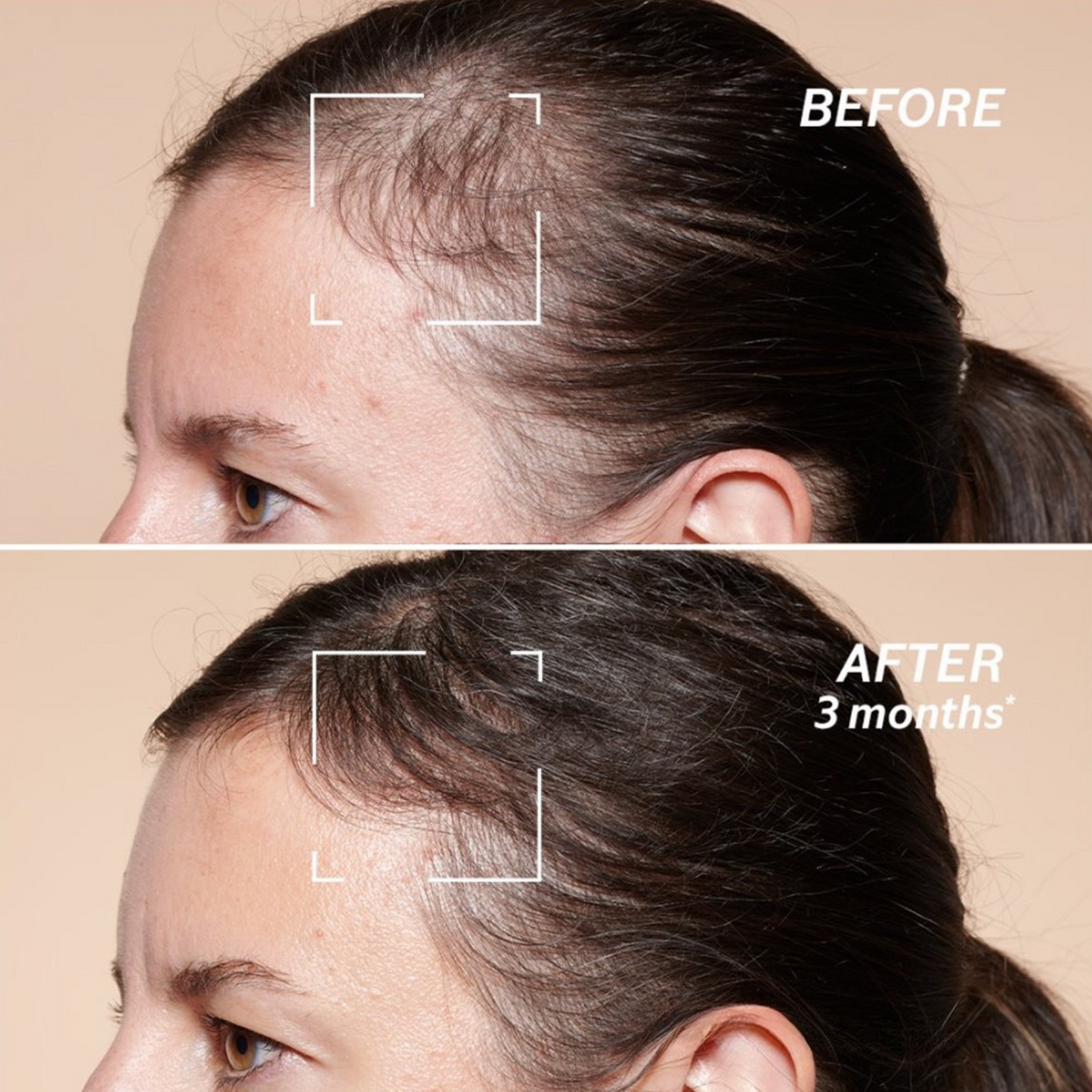 Anti-Hair Loss Advanced Scalp Treatment