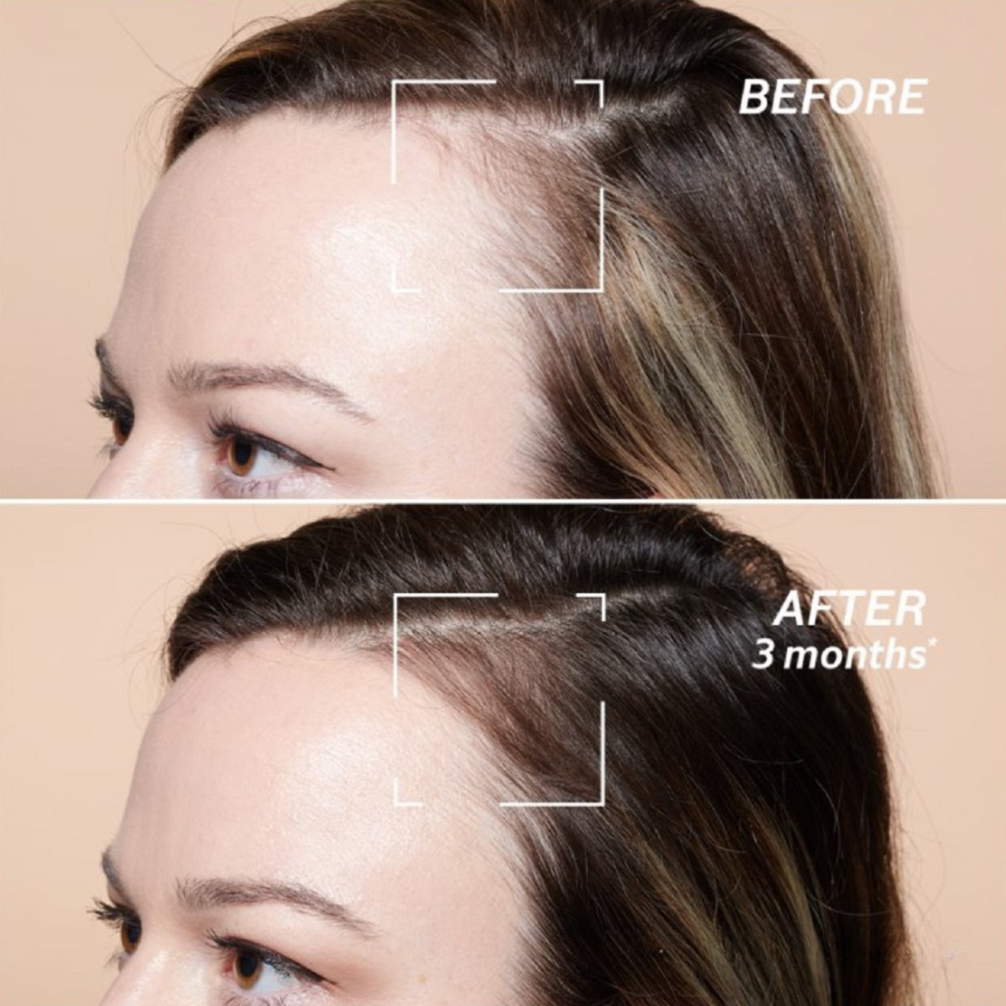 Anti-Hair Loss Advanced Scalp Treatment